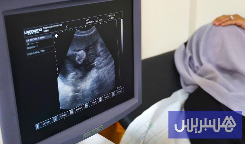 دراسة تكشف استمرار النشاط البيولوجي للمبايض بعد انقطاع الطمث دراسة تكشف استمرار النشاط البيولوجي للمبايض بعد انقطاع الطمث