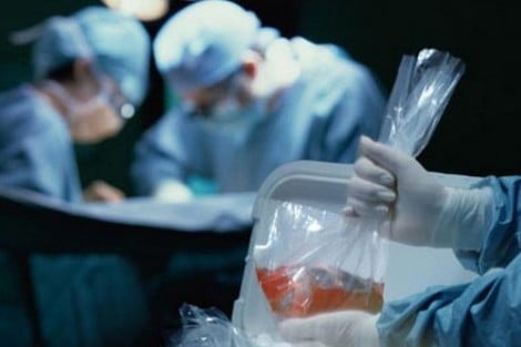 لماذا يتوجّس المغاربة منَ التبرع بالأعضاء البشرية؟