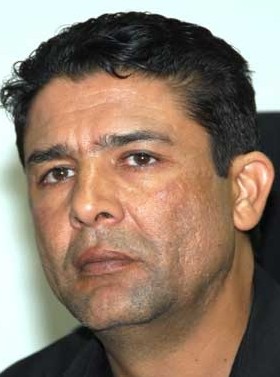 خواطر على هامش "اليوم العالمي لسلخ الشعر"