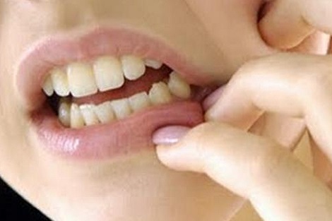 هذه بضع طرق للتغلب على آلام الأسنان بسرعة