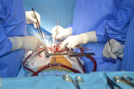 الشرطة تداهم "ورشة التجميل السرّي" في مراكش