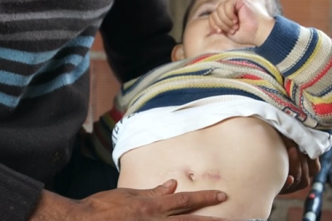 نداء إنساني لإنقاذ الطفل أيّوب من مرض عضال