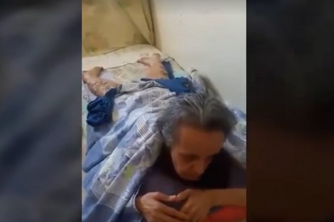 الديدان تعبث في سيقان جميلة .. والفقر يفاقم جرعة الآلام