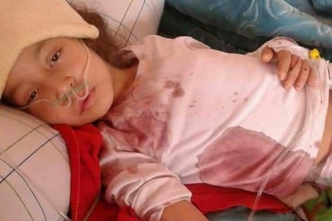 نزيف دموي دائم لطفلة من شفشاون يحيّر الأطباء