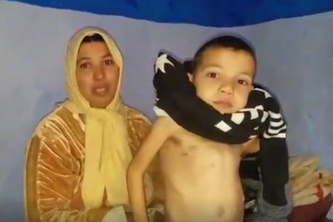 العثماني يكابد مأساة اعوجاج في عموده الفقري