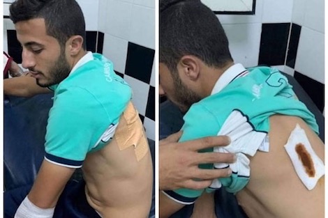 مجهولون يعتدون على لاعب ودادي بالسلاح الأبيض