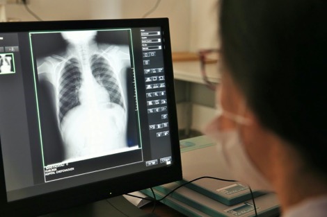 الوضع الوبائي في المغرب .. 52 حالة شفاء جديدة من "كورونا"