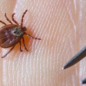 حشرة القُراد تصيبك بهذه الأمراض الخطيرة
