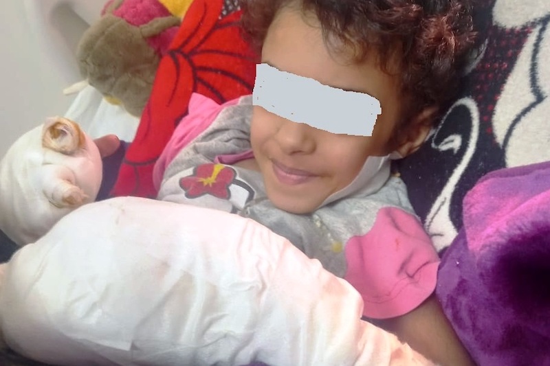 هذه مستجدات قضية حروق الطفلة "لينا"