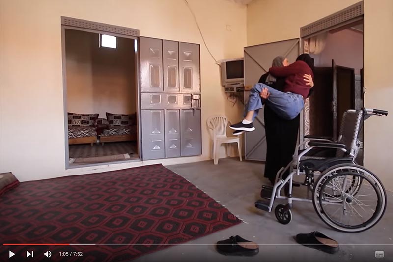 شلل بعد تلقي لقاح كورونا