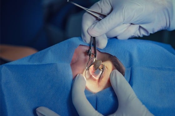 جراح يخطط لاستعادة نظر 500 ألف شخص حول العالم