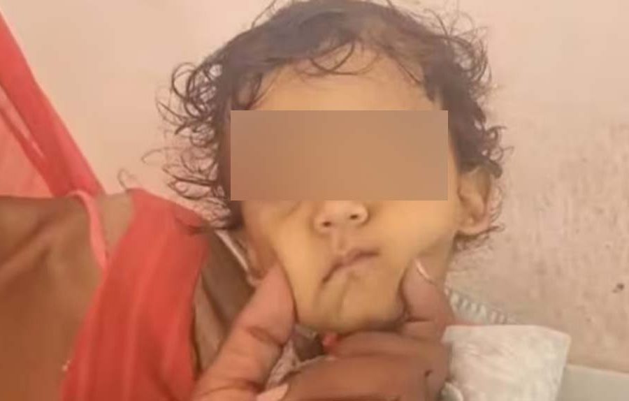 في حادثة غريبة .. رضيع يعض ثعبانا حتى الموت