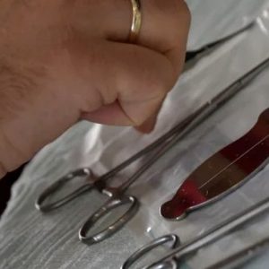 ارتفاع ضحايا الختان الجماعي بشفشاون