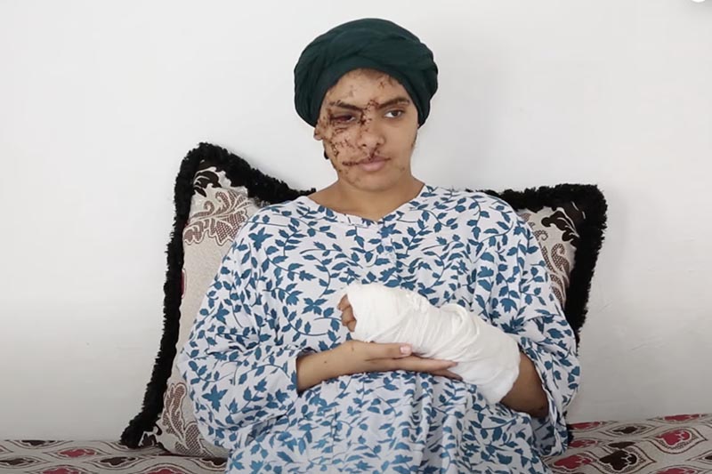 إيمان تحكي عن الاعتداء الوحشي