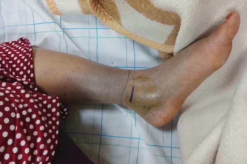 وفاة في طاطا تطرح أزمة الأمصال