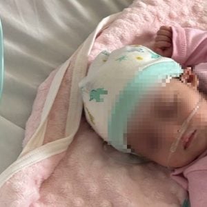 ثقب في القلب يهدد حياة الرضيعة غالية