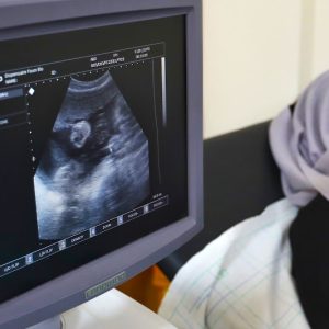 دراسة تكشف استمرار النشاط البيولوجي للمبايض بعد انقطاع الطمث