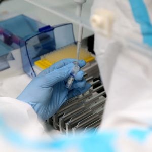 الاشتباه في "حالة دفتيريا" بسطات